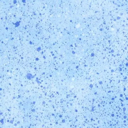 Light Blue Spatter Print